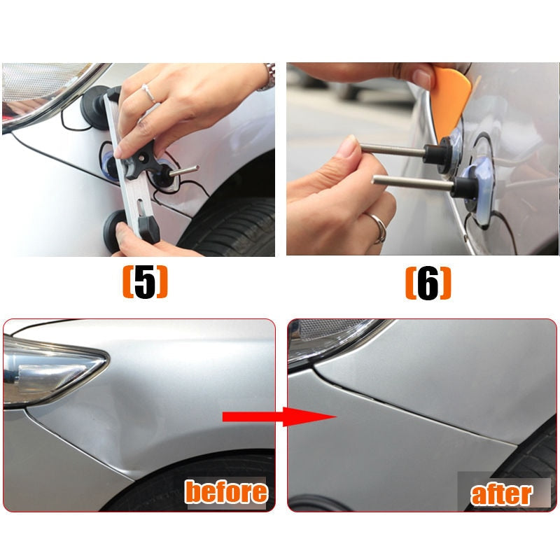 Dent Puller Lifter Paintless Removal Hail Remover Tools Car Auto Repair Tab  Kit